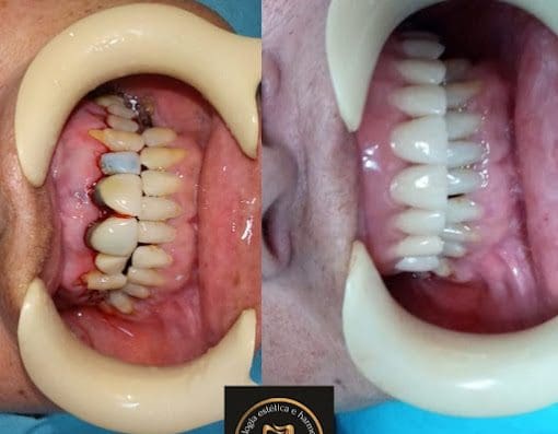 Dentista – Torres Odontologia