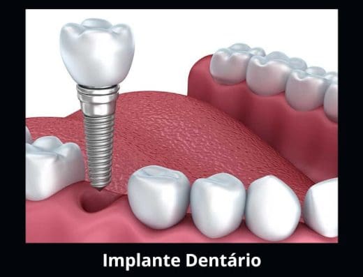 Dentista – Torres Odontologia
